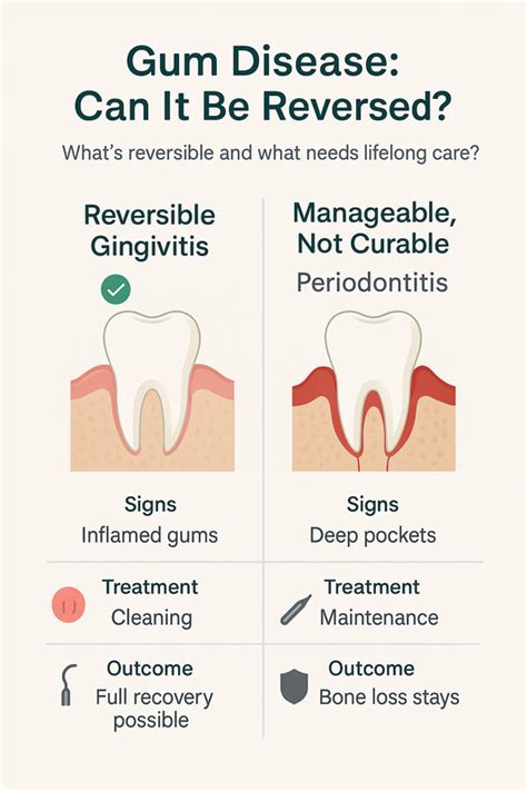 Is Gingivitis Reversible