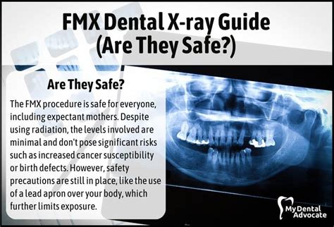 Is It Safe To Xray Teeth