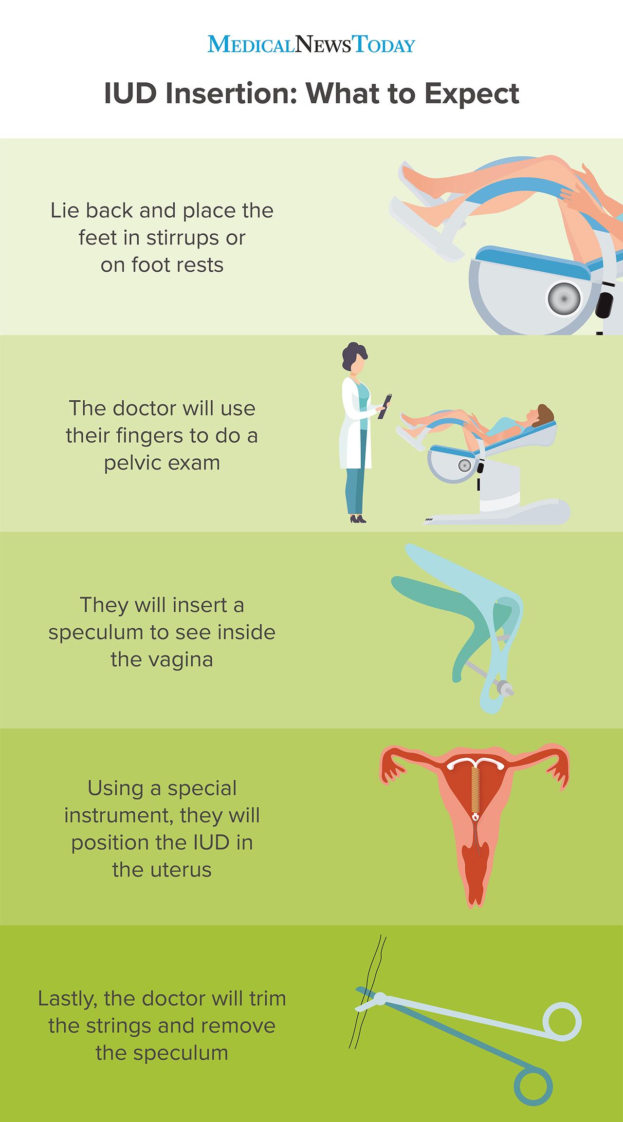 Iud Effective Rate
