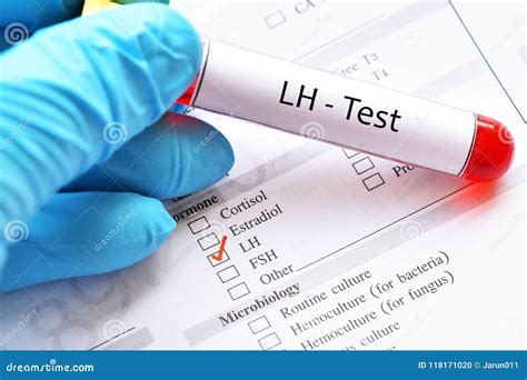 Lh Blood Test