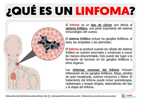 Linfoma Que Es