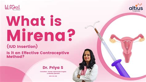Mirena Iud Insertion
