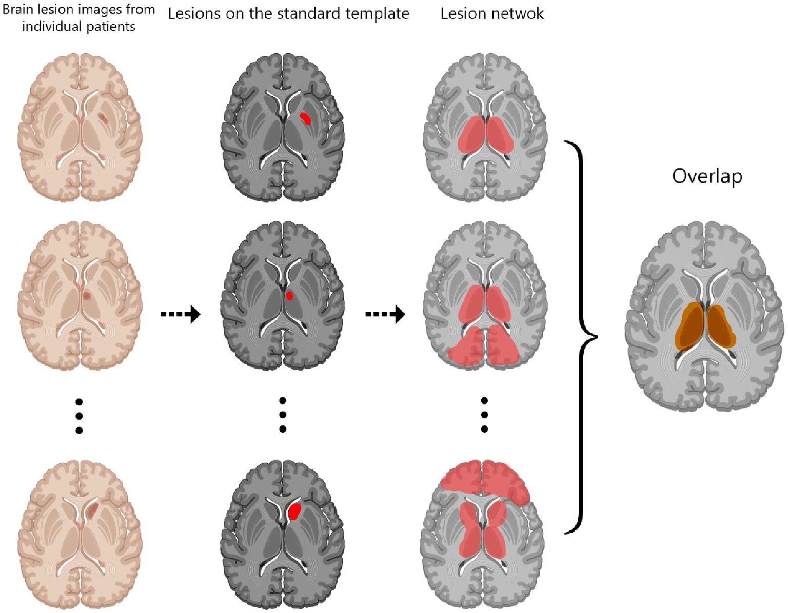 Mri Imaging Machine