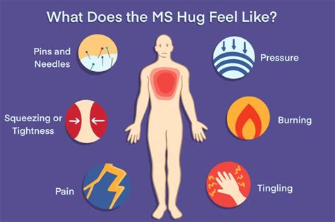 Ms Hug Symptoms