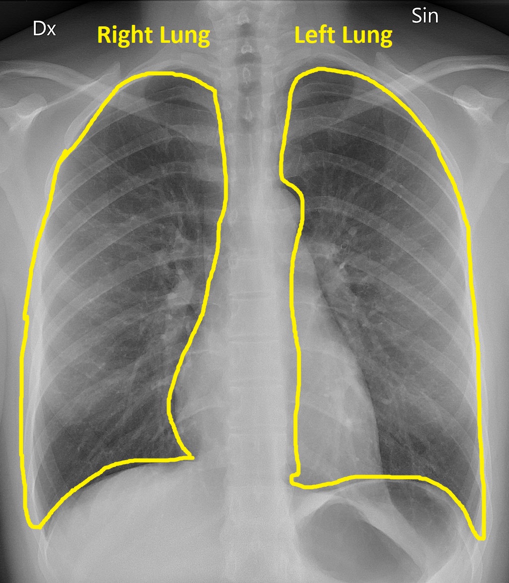 Normal Common Bile Duct Size