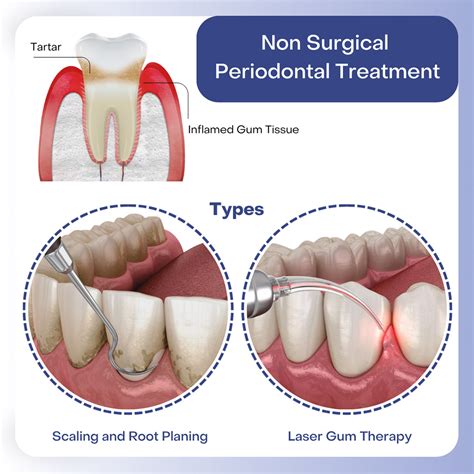 Top Periodontal Treatment Australia Options for Healthy Gums