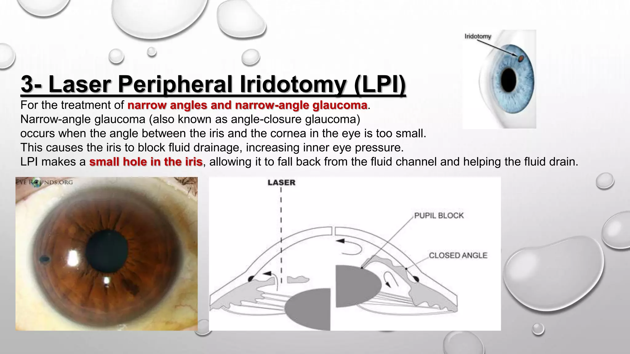 Peripheral Nerve Stimulation