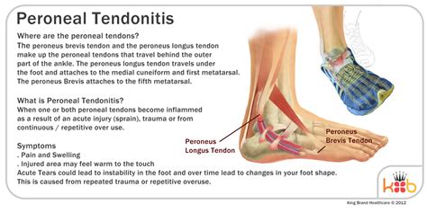Peroneal Tendonitis Treatment