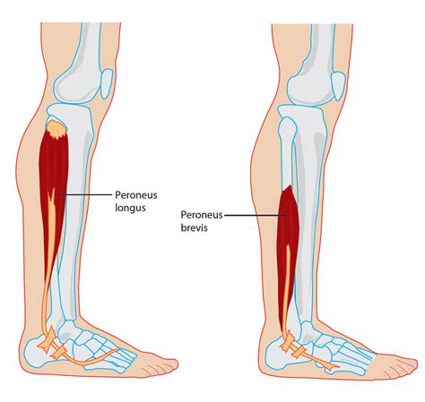 Peroneus Brevis Pain