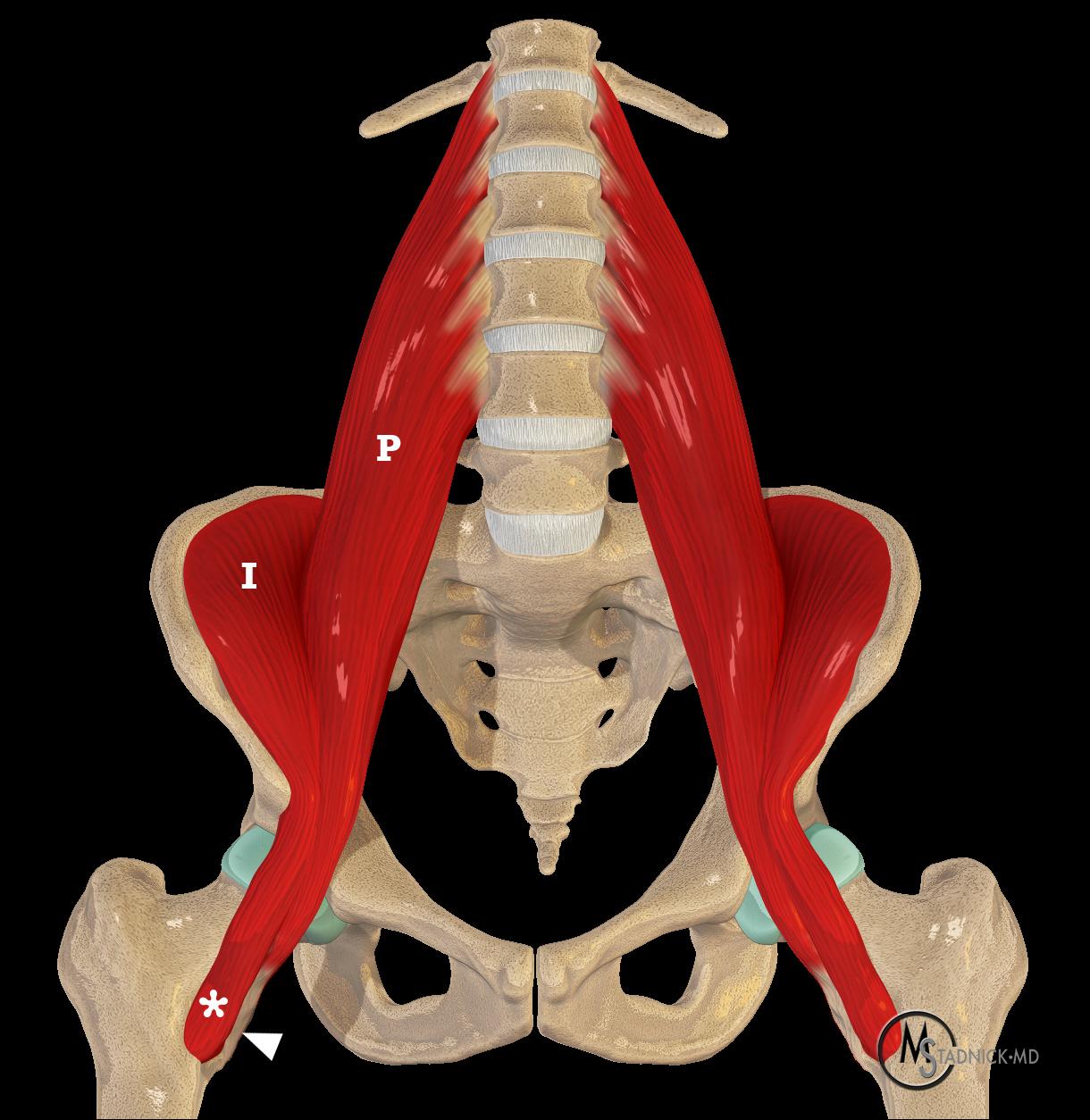 Psoas Making Leg Numb