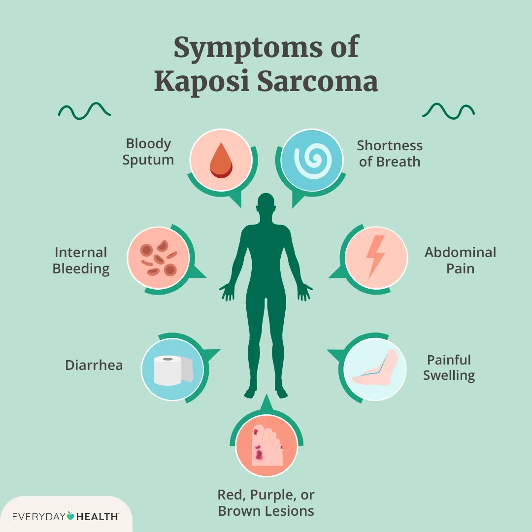 Sarcoma Vs Carcinoma