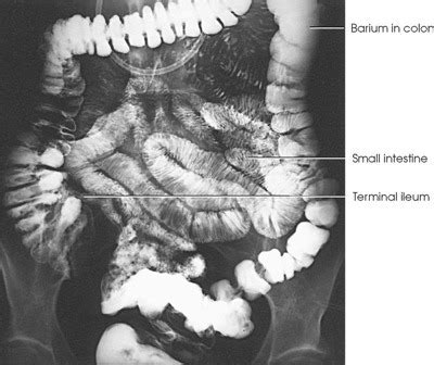 Sbft Medical Abbreviation