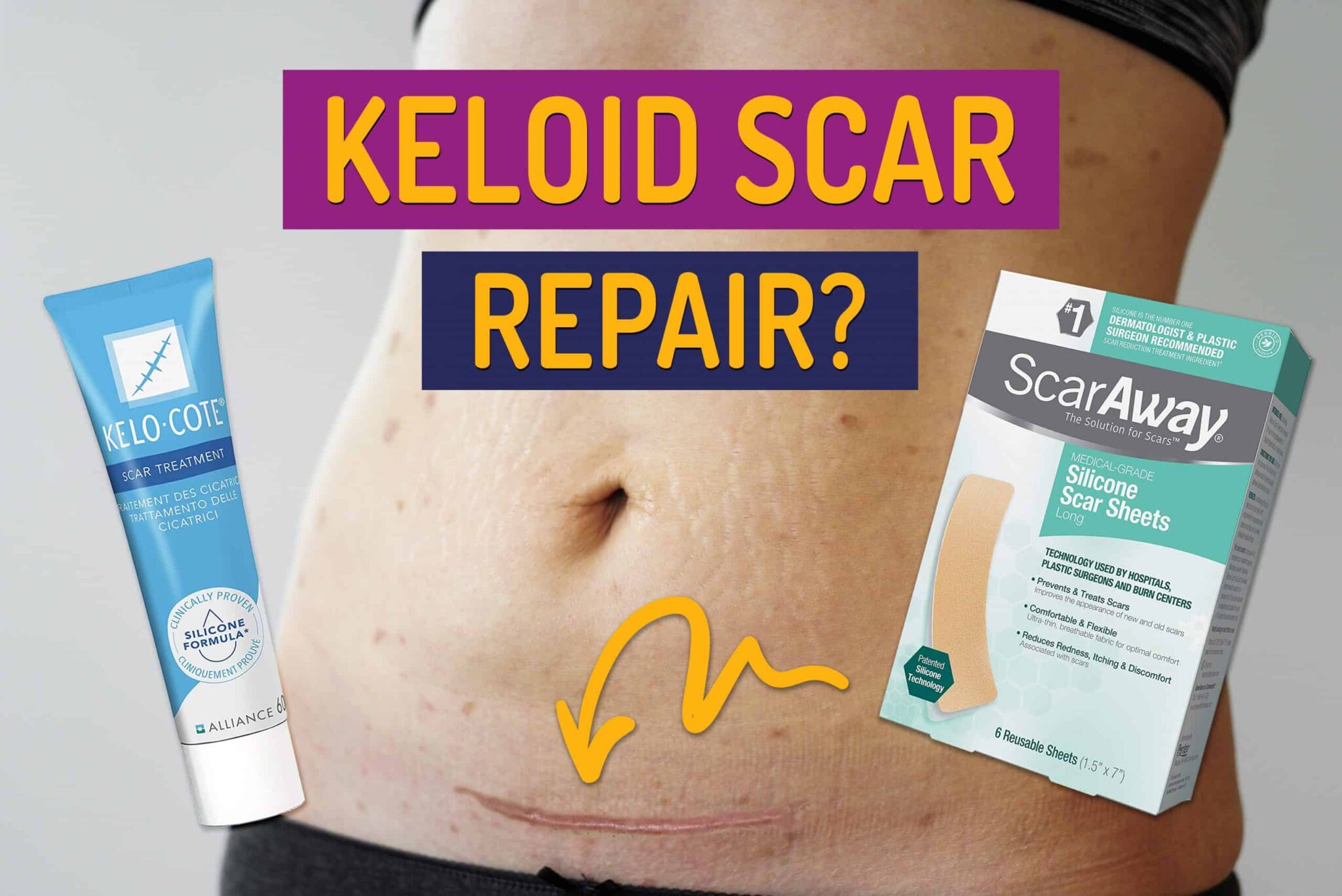 Scar Surgery On Face