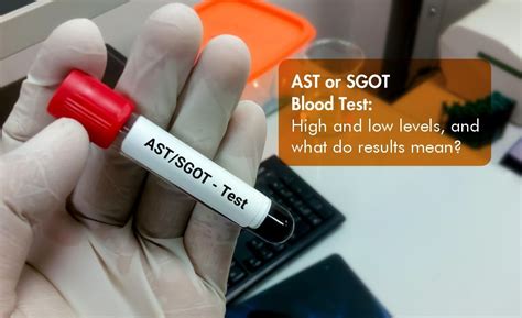 Sgot Low In Blood Test