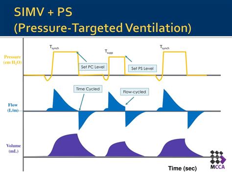 Simv Mode Of Ventilator