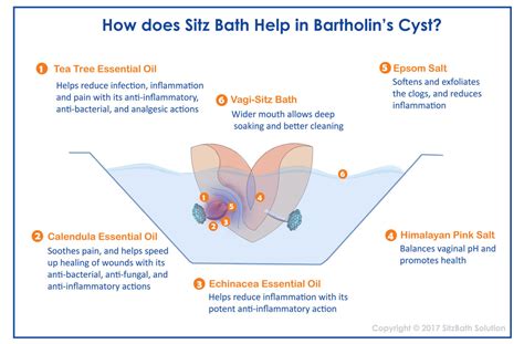 Sitz Bath For Bartholin Cyst