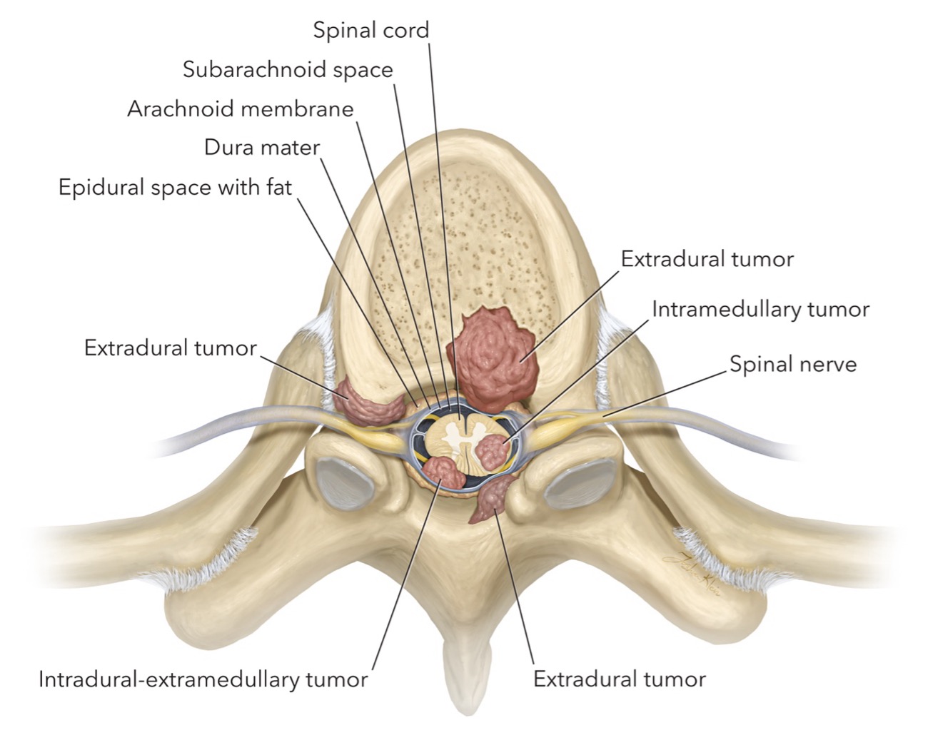 Spinal Decompression Machine