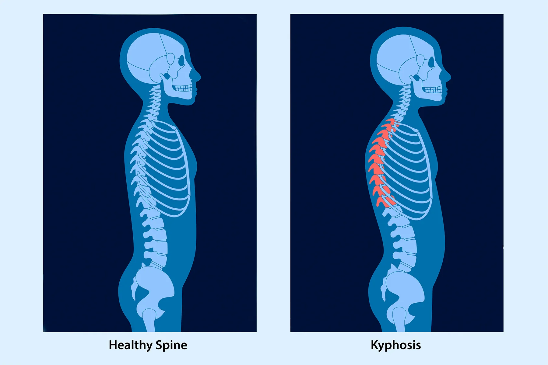 Spine Disc Anatomy