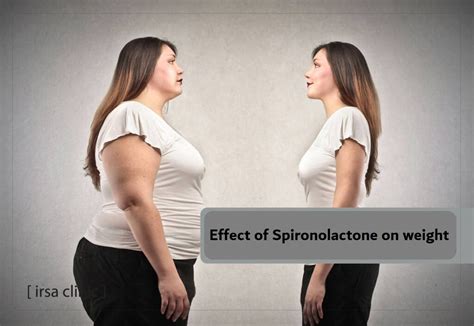 Spironolactone Does It Cause Weight Gain