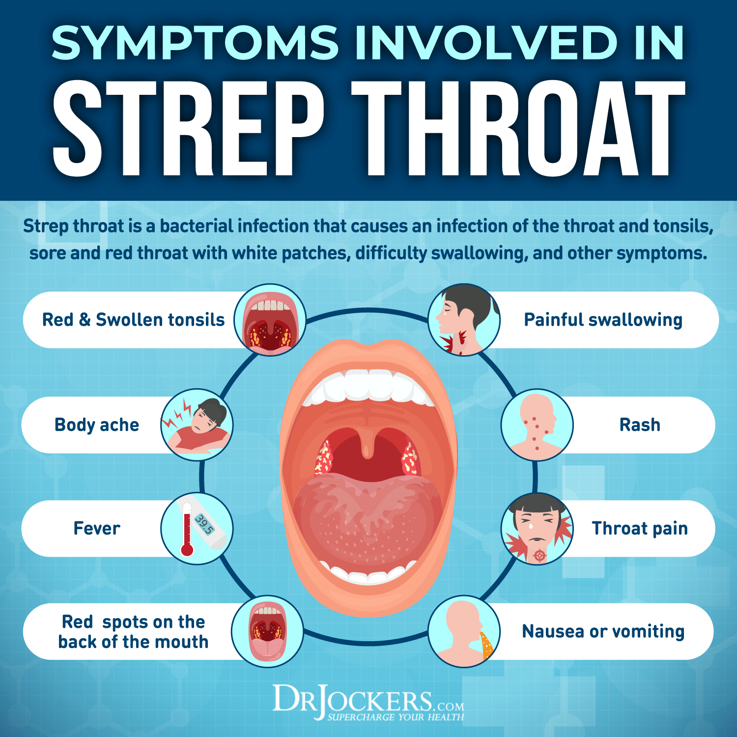 Strep Infection