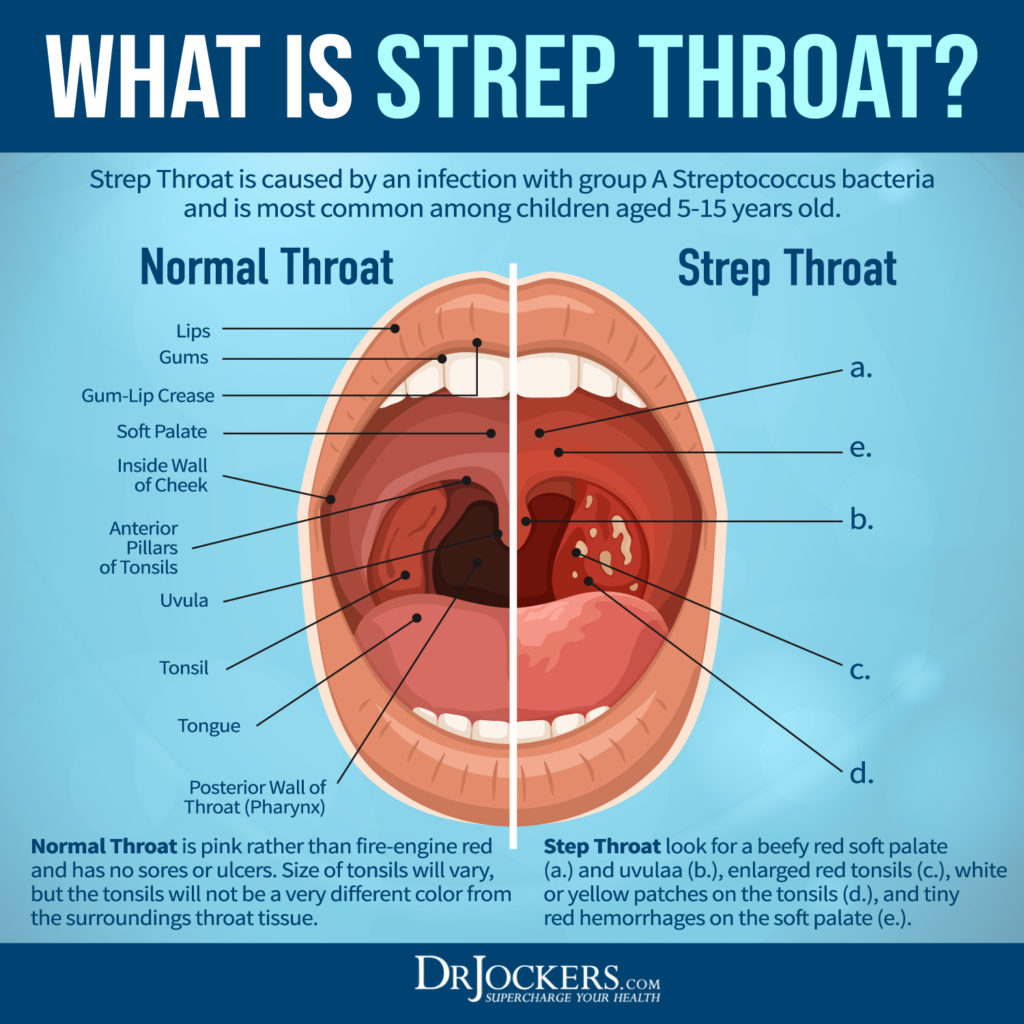 Strep Of The Buttocks