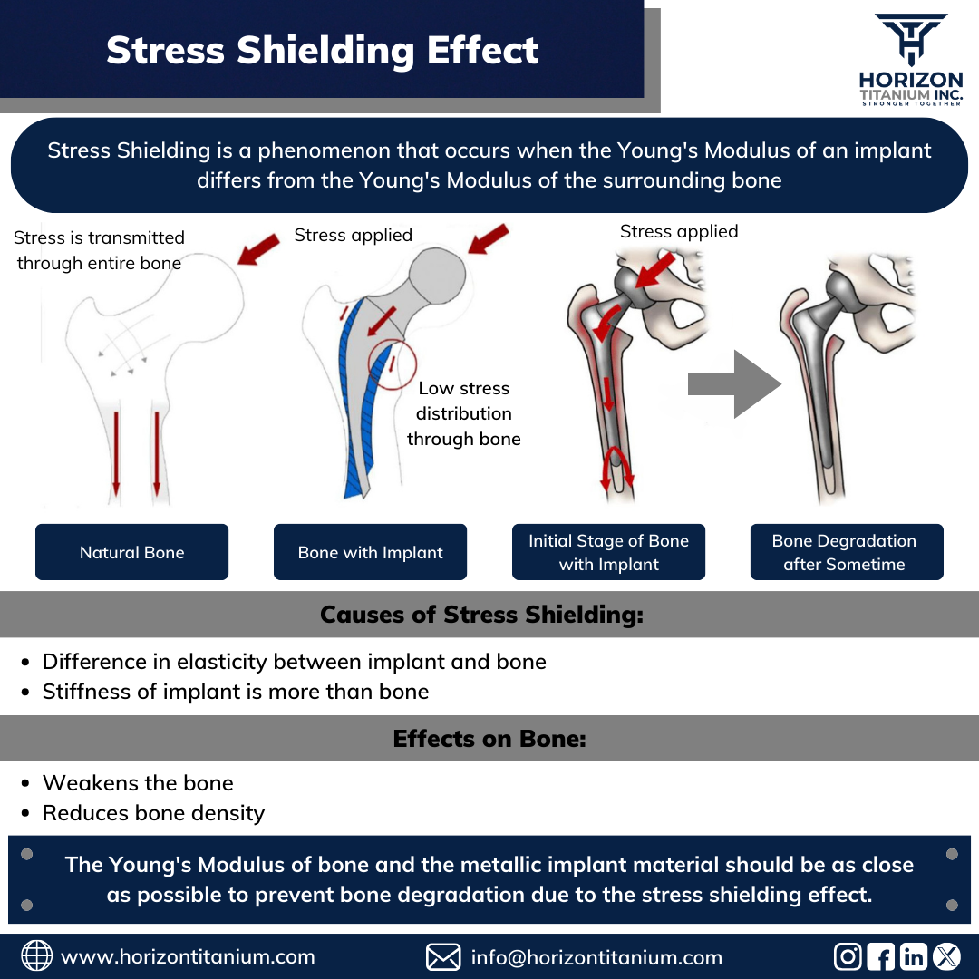 Stress Test For Heart