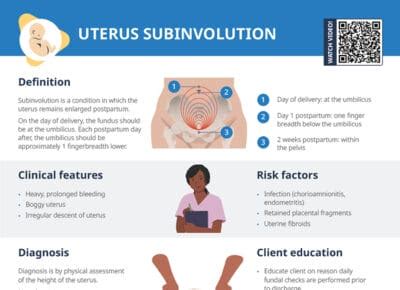 Subinvolution Of Uterus