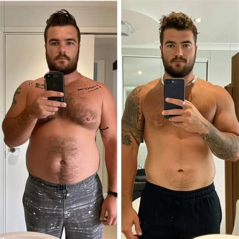 Tesamorelin Before And After
