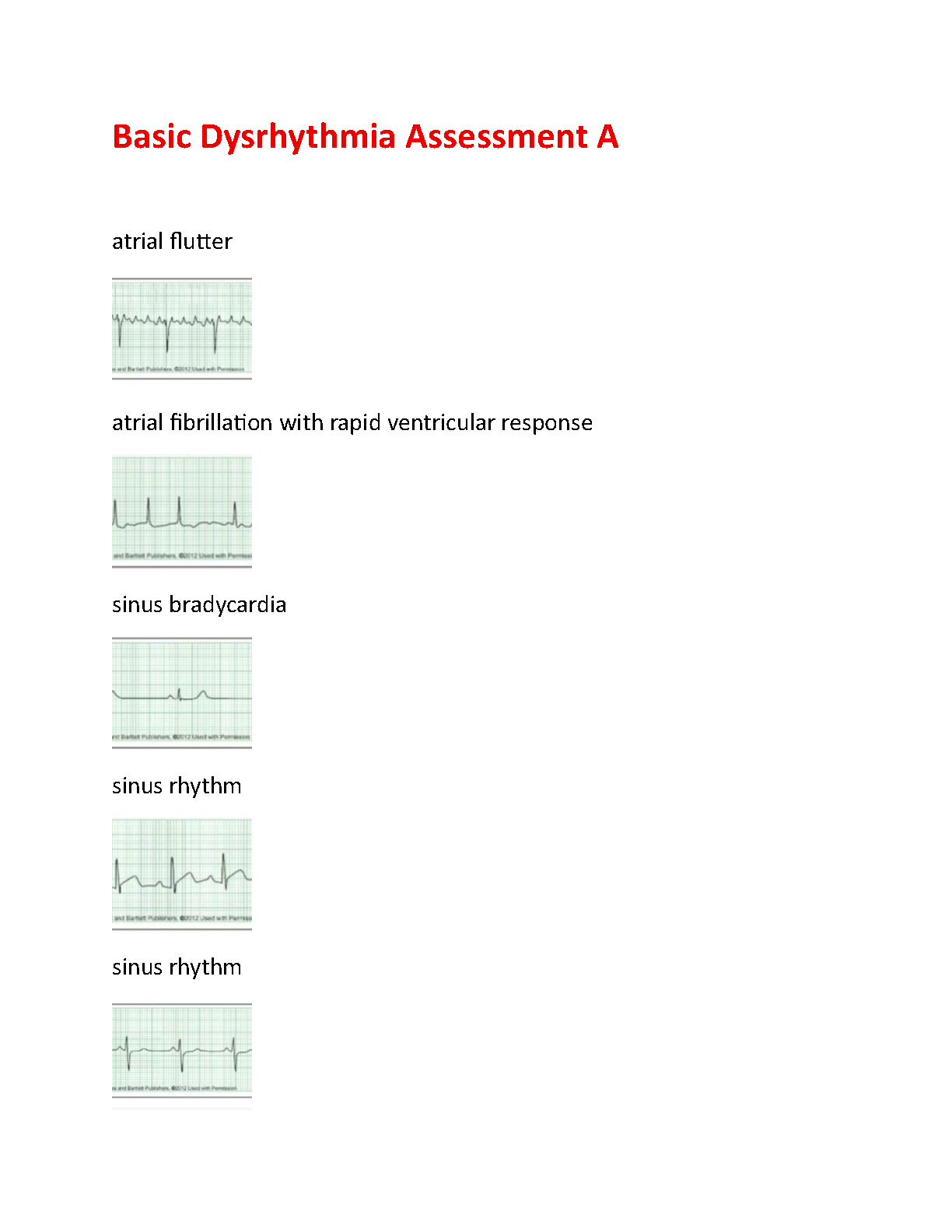Test Van Finkelstein