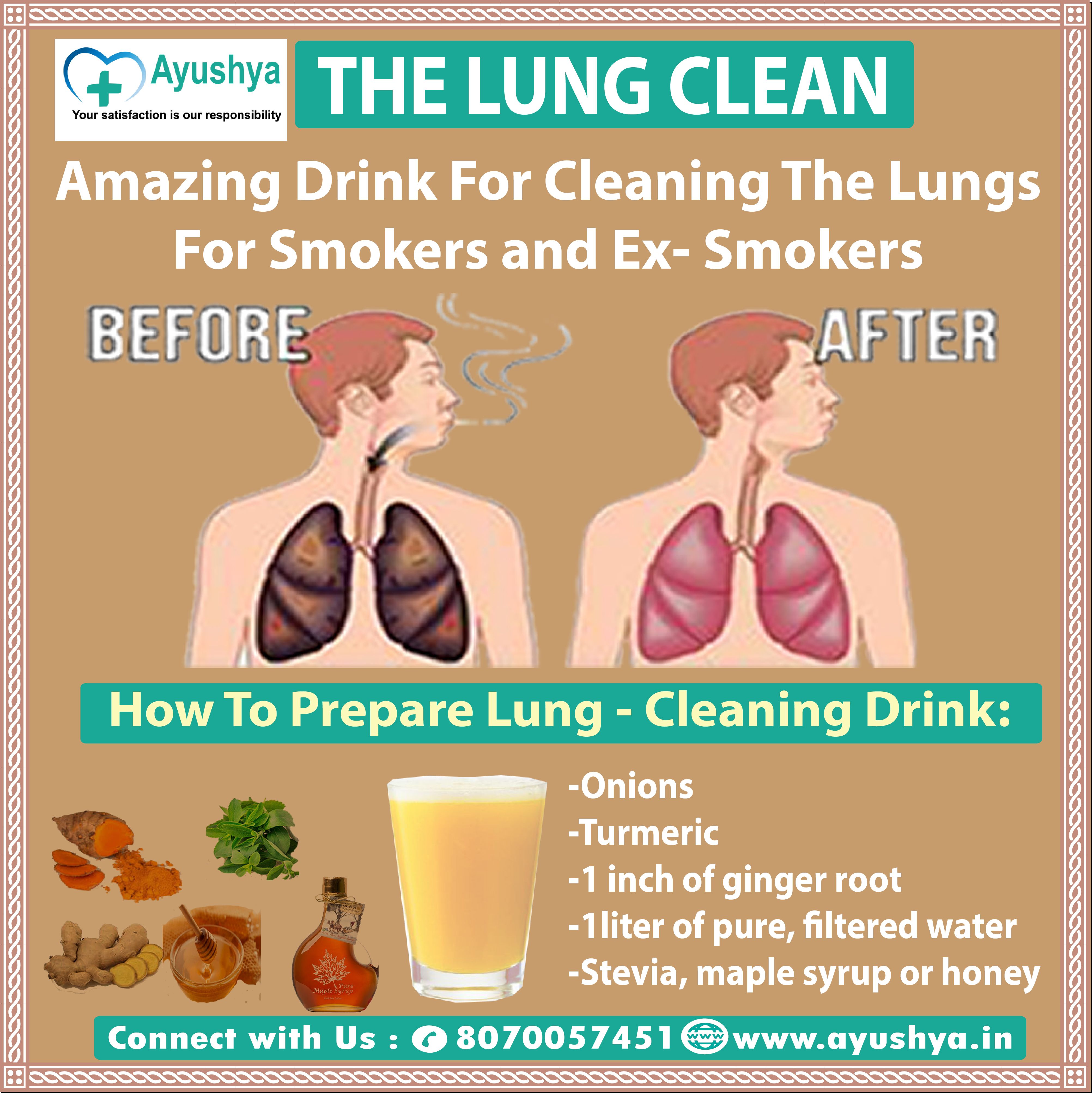 Thoracentesis Pleural Tap