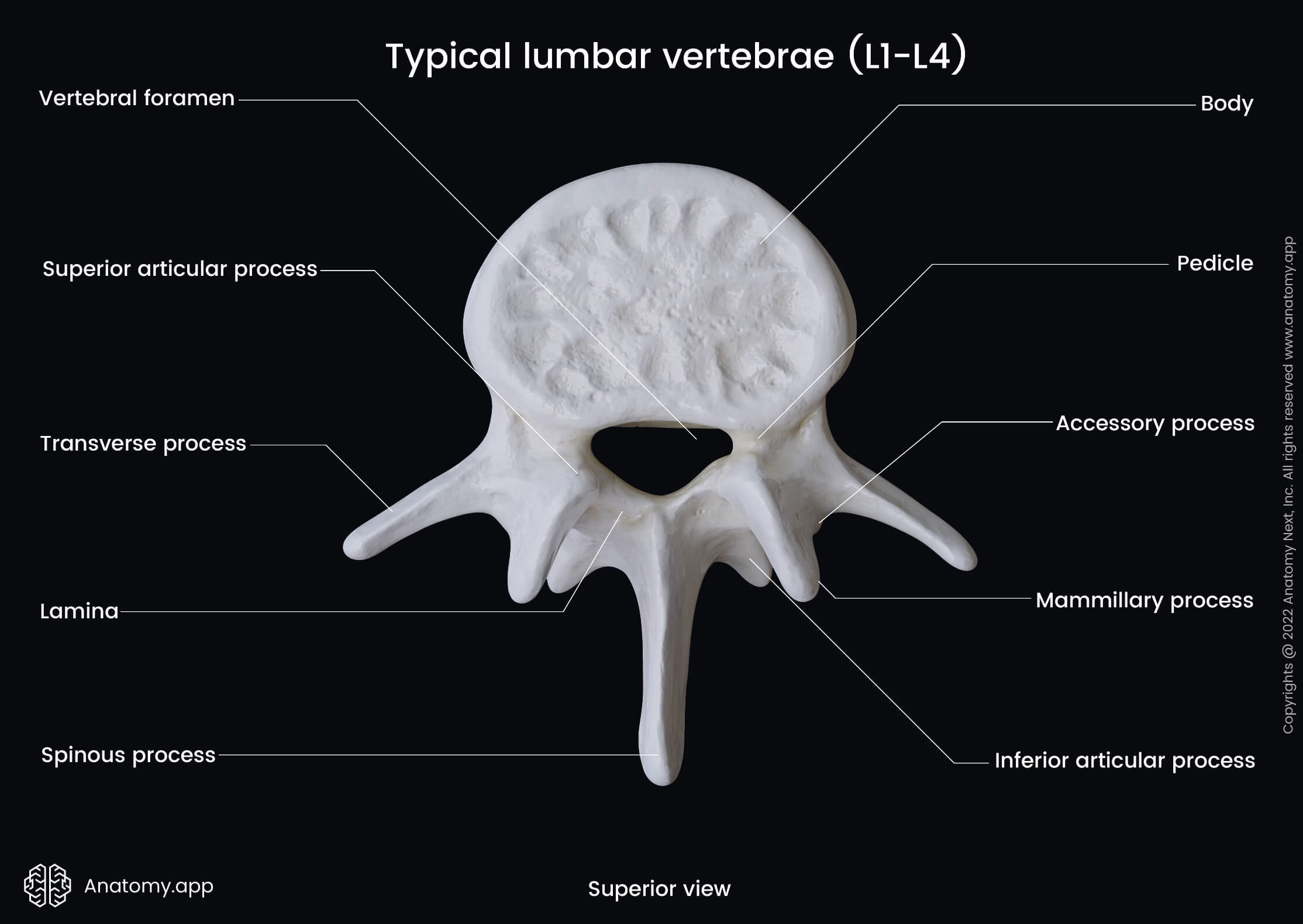 Thoracic Aorta Ectasia