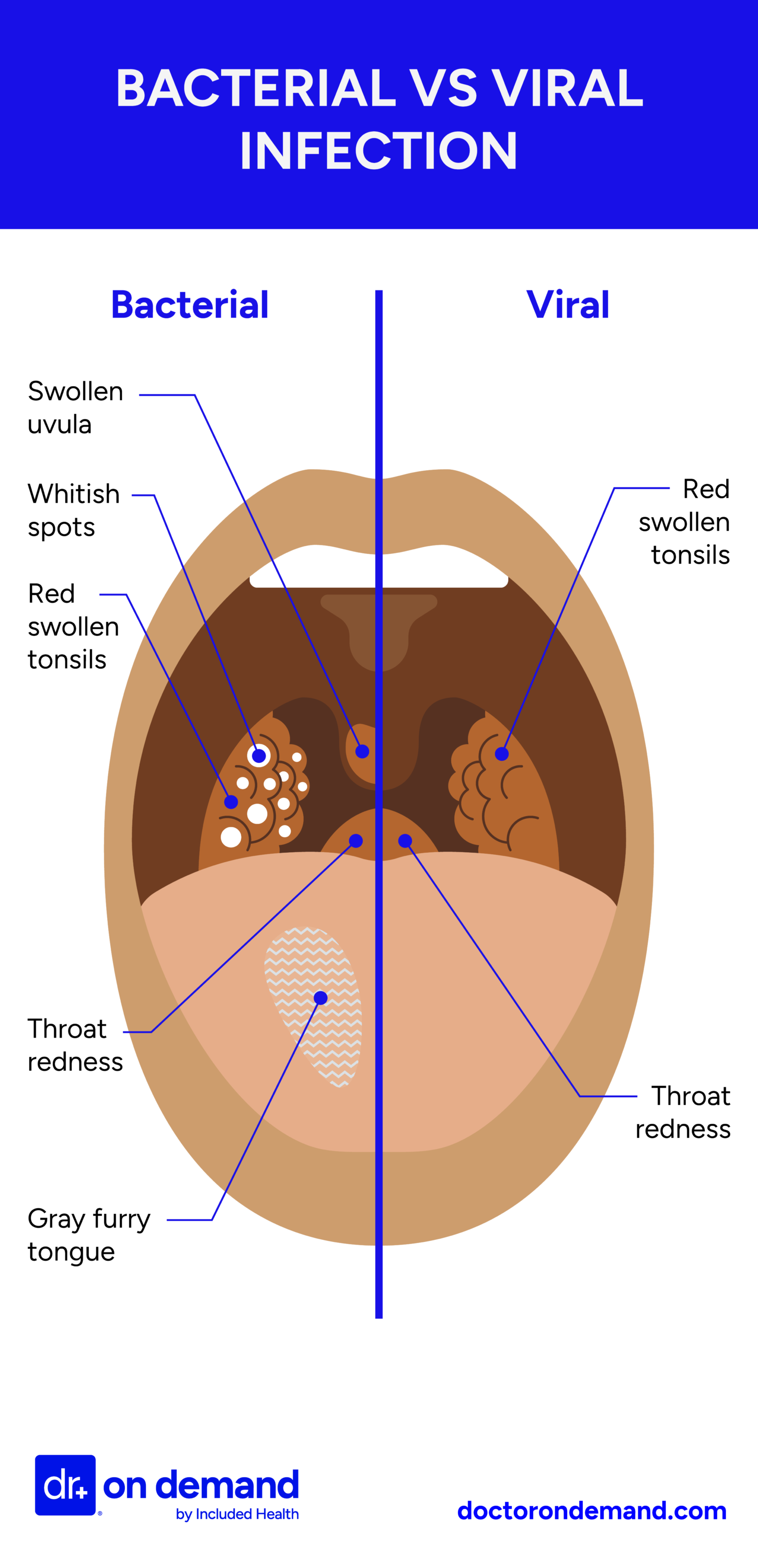 Throat With Bumps On Back