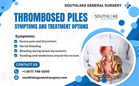 Thrombosed Piles Images