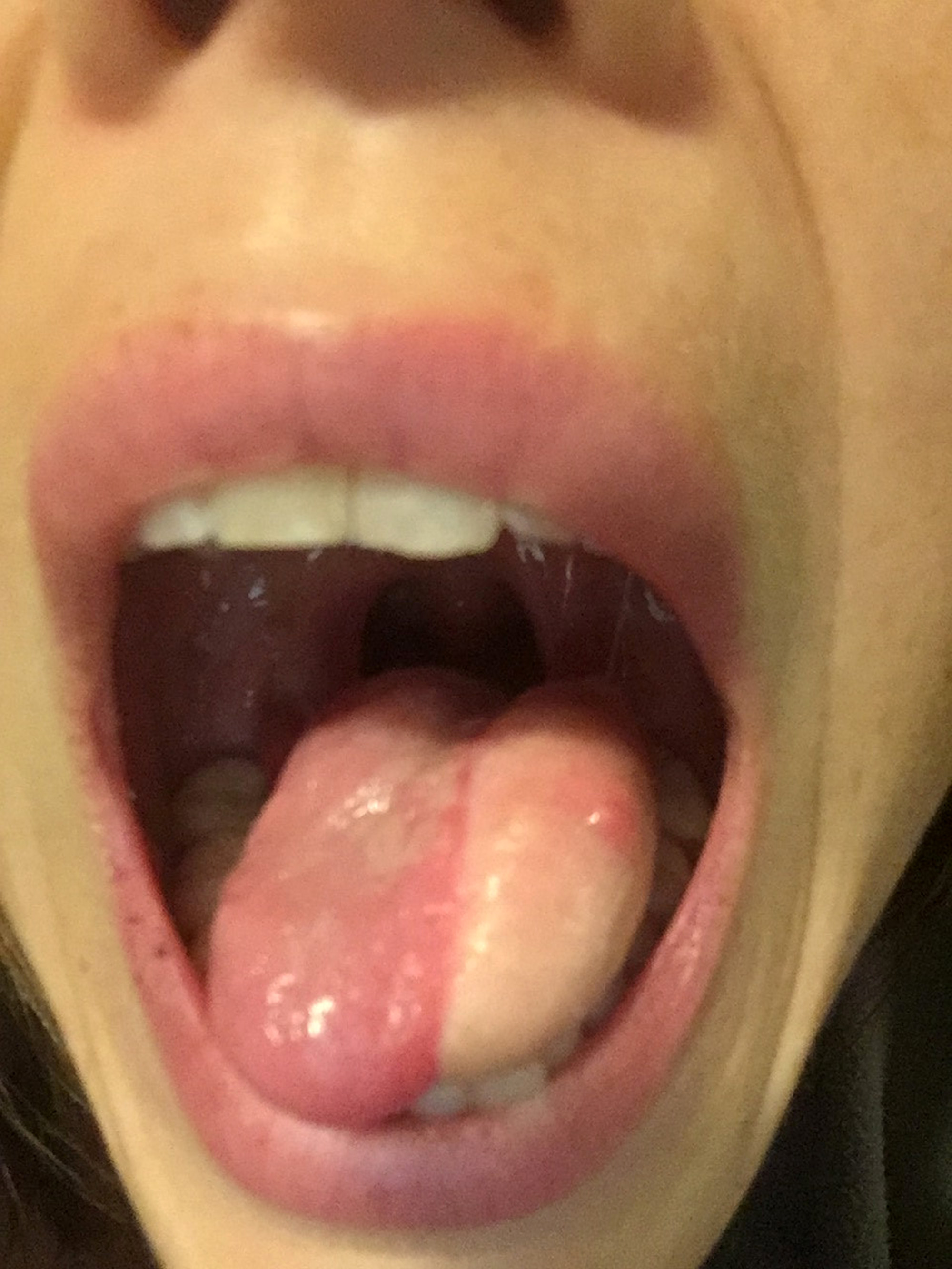 Tongue With Splits