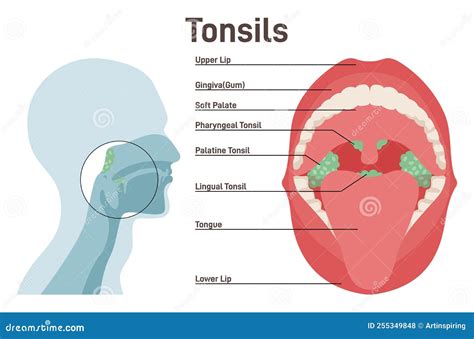 Tonsil And Lymph Nodes