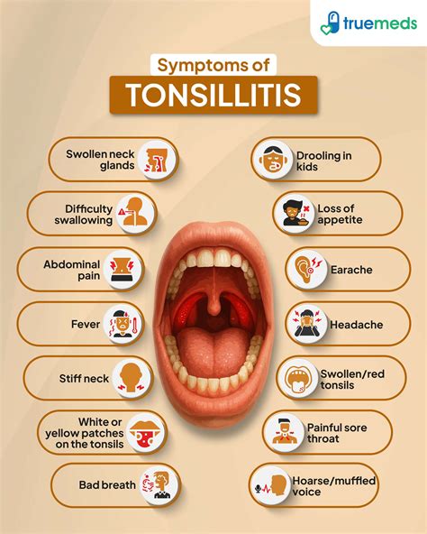 Tonsillitis Symptoms And Signs