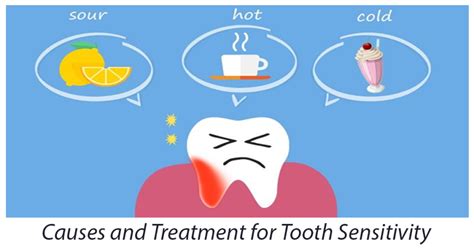 Best Tooth Sensitivity Treatment Secrets Revealed