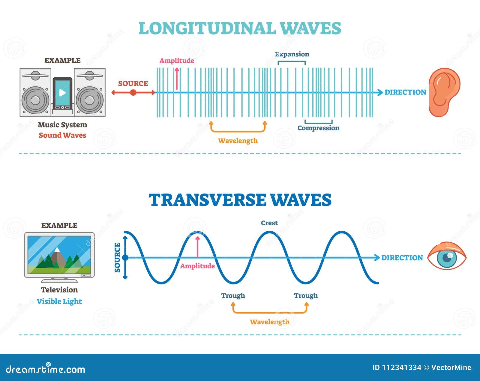 Transverse Temporal Gyrus