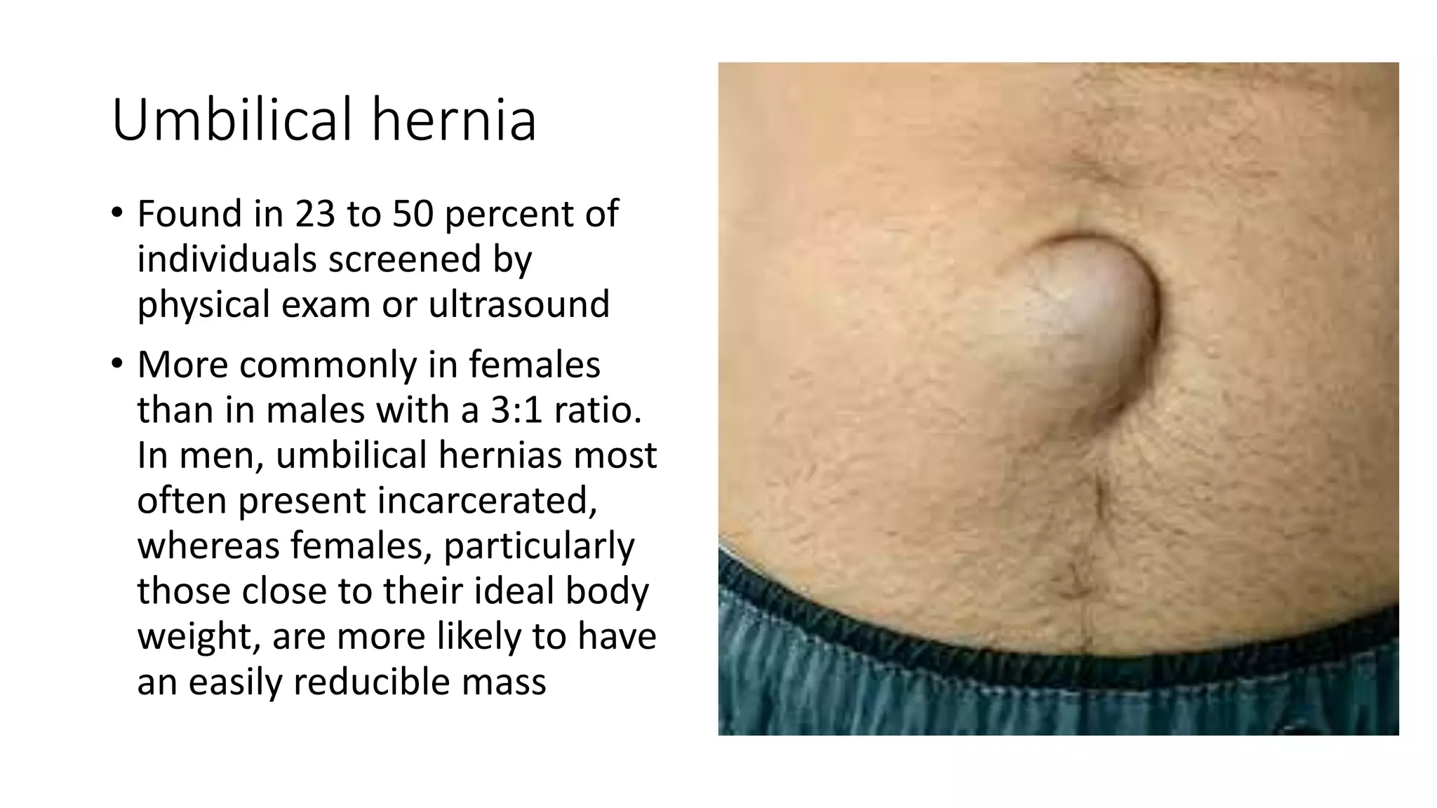 Umbilical Cord Bleeding