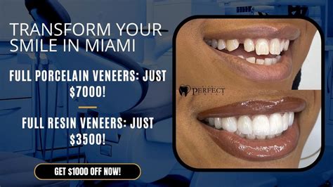 Get the Best Veneers for Teeth Cost in Los Angeles: Your Guide to Affordable Smiles