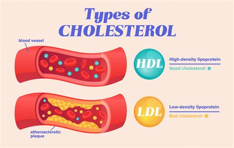 What Affects Cholesterol