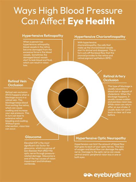 What Affects Eye Pressure