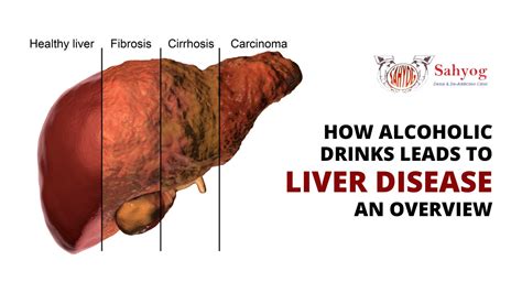 What Affects Liver