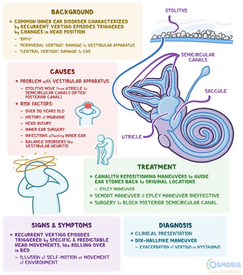 What Affects Vertigo