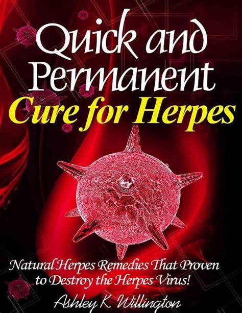 What Cures Herpes