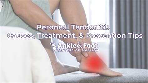 What Cures Tendonitis