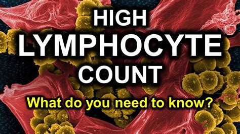 What Does High Lymphs Mean