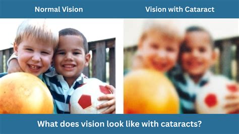 What Does Vision Look Like