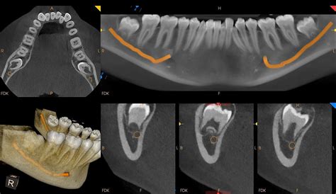 What Is A Cbct Scan