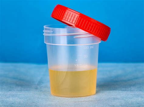 What Is A Urine